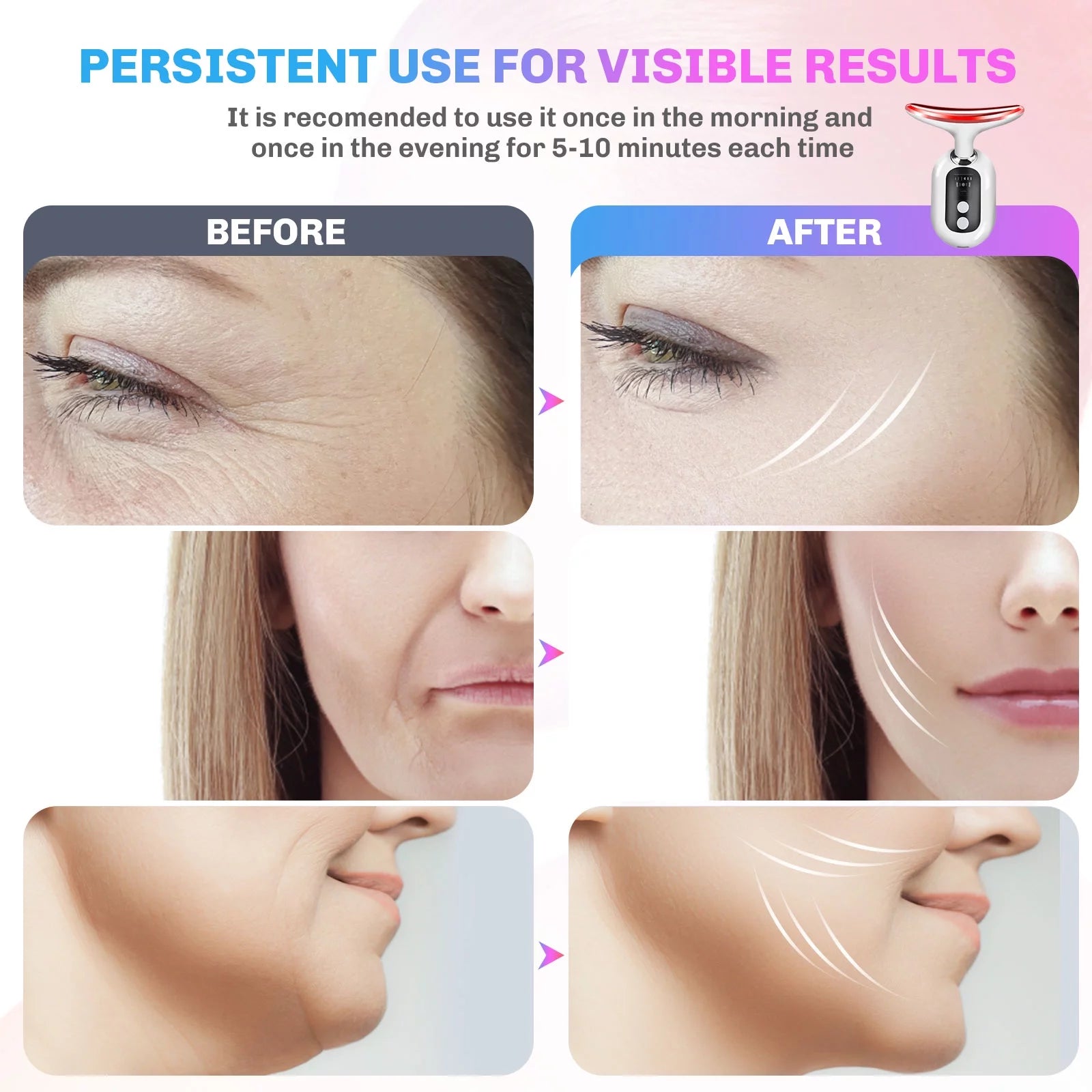 Firming Wrinkle Removal Device for Neck and Face
